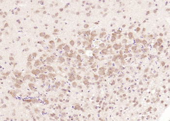 ChAT Rabbit Polyclonal Antibody