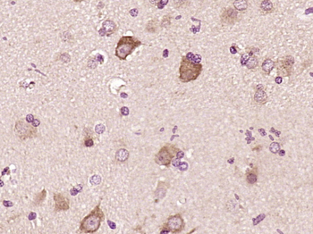 CHK1 Rabbit Polyclonal Antibody