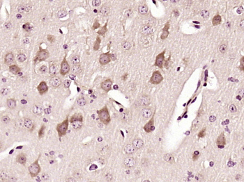 CHK1 Rabbit Polyclonal Antibody