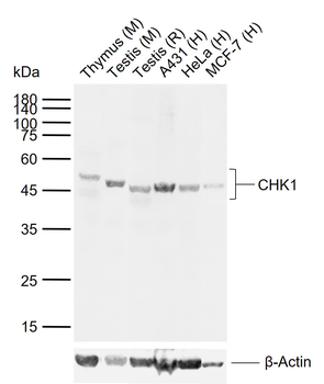 CHK1 Rabbit Polyclonal Antibody