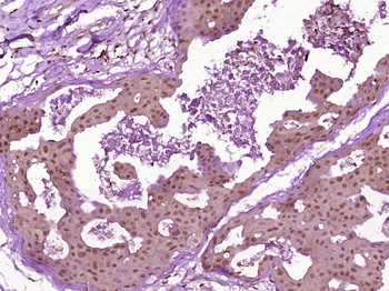 CHEK2 Rabbit Polyclonal Antibody