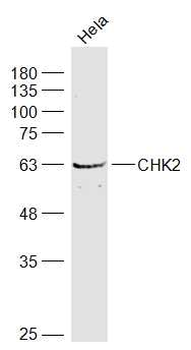 CHEK2 Rabbit Polyclonal Antibody