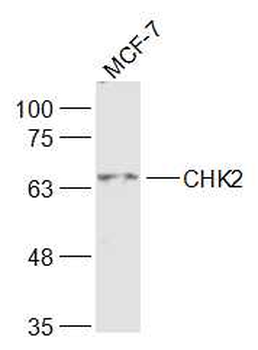 CHEK2 Rabbit Polyclonal Antibody