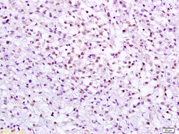 CHEK2 Rabbit Polyclonal Antibody