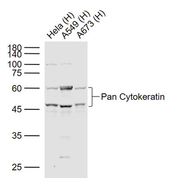 Pan Cytokeratin Rabbit Polyclonal Antibody