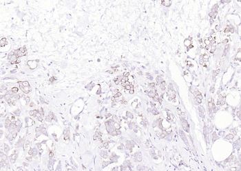 Pan Cytokeratin Rabbit Polyclonal Antibody