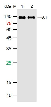 SARS-CoV-2 (2019-nCoV) Spike S1 Mouse Monoclonal Antibody