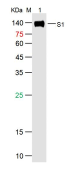 SARS-CoV-2 (2019-nCoV) Spike S1 Mouse Monoclonal Antibody