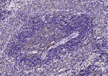 CCR7 Rabbit Polyclonal Antibody