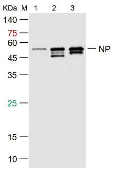 SARS-CoV-2 (2019-nCoV) Nucleocapsid, WT & Ormicron Recognized Recombinant Rabbit Monoclonal Antibody