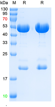 SARS-CoV-2 (2019-nCoV) Nucleocapsid, WT & Ormicron Recognized Recombinant Rabbit Monoclonal Antibody
