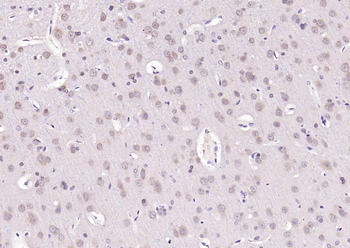 APG4B (Acetyl K39) Rabbit Polyclonal Antibody
