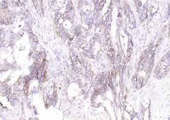 TGF beta Receptor I Mouse Monoclonal Antibody