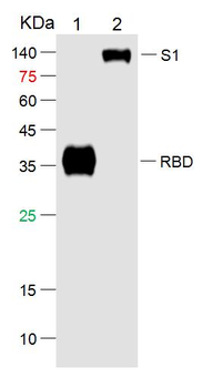 SARS-CoV-2 (2019-nCoV) Spike RBD Mouse Monoclonal Antibody
