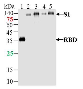 SARS-CoV-2 (2019-nCoV) Spike RBD Mouse Monoclonal Antibody