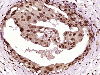 Cytokeratin 5 Rabbit Polyclonal Antibody