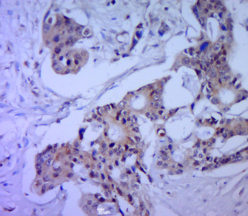 Cytokeratin 5 Rabbit Polyclonal Antibody