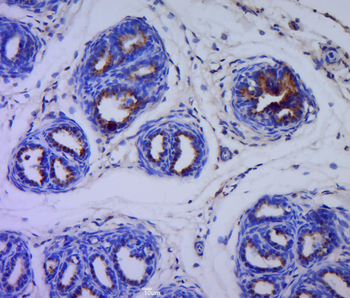 Cytokeratin 5 Rabbit Polyclonal Antibody