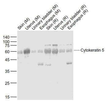 Cytokeratin 5 Rabbit Polyclonal Antibody