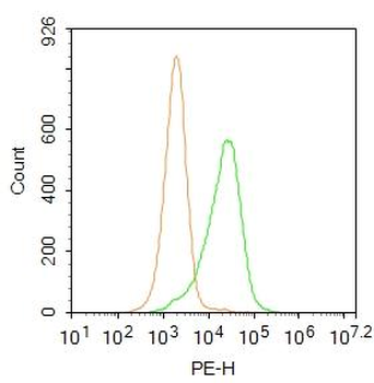 CK7 Rabbit Polyclonal Antibody