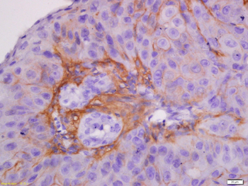 CK7 Rabbit Polyclonal Antibody