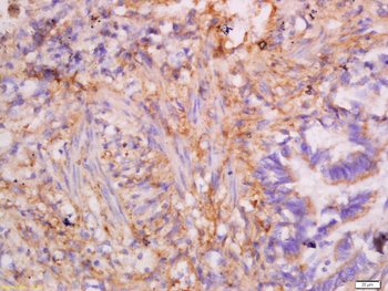 CK7 Rabbit Polyclonal Antibody