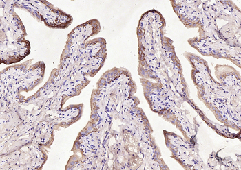 CK7 Rabbit Polyclonal Antibody