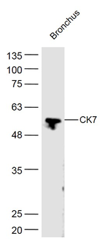 CK7 Rabbit Polyclonal Antibody