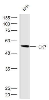 CK7 Rabbit Polyclonal Antibody
