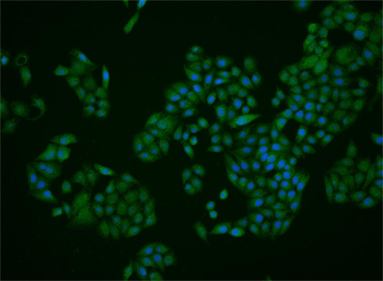 Cytokeratin 6 Rabbit Polyclonal Antibody