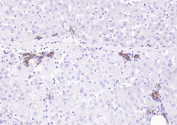 Cytokeratin 8 Rabbit Polyclonal Antibody