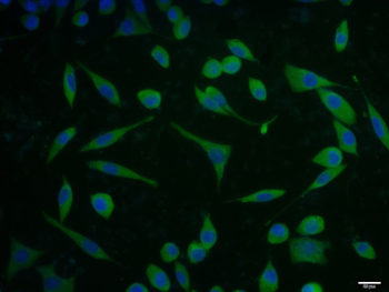 Cytokeratin 8 Rabbit Polyclonal Antibody