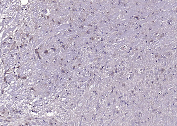 PLEKHO1 Rabbit Polyclonal Antibody
