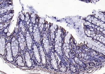 PLEKHO1 Rabbit Polyclonal Antibody