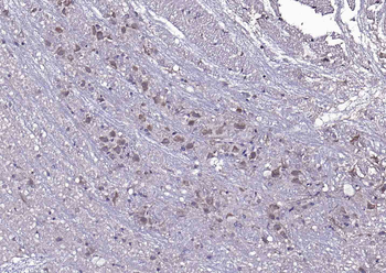 PLEKHO1 Rabbit Polyclonal Antibody