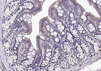 PLEKHO1 Rabbit Polyclonal Antibody