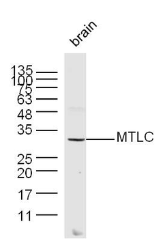 MTLC Rabbit Polyclonal Antibody