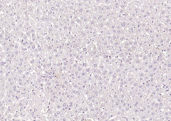 CNR1 Rabbit Polyclonal Antibody