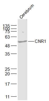 CNR1 Rabbit Polyclonal Antibody
