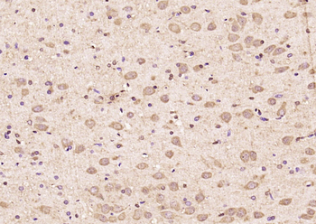 PCDA6 Rabbit Polyclonal Antibody
