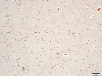 CNTF Rabbit Polyclonal Antibody