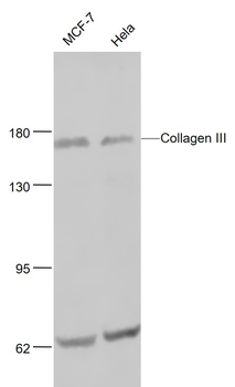 Collagen III Rabbit Polyclonal Antibody
