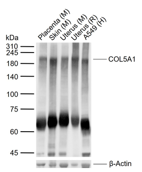 COL5A1 Rabbit Polyclonal Antibody
