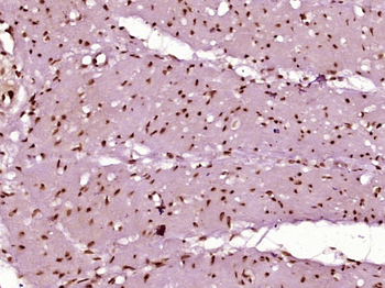 CDX2 Rabbit Polyclonal Antibody