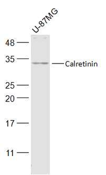 CALB2 Rabbit Polyclonal Antibody