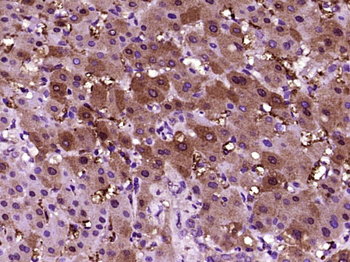 CRP Rabbit Polyclonal Antibody