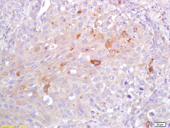 CRP Rabbit Polyclonal Antibody