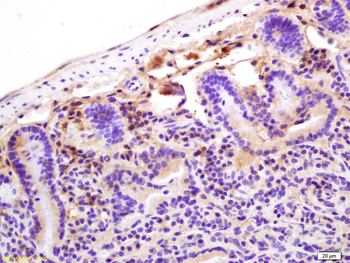 CRP Rabbit Polyclonal Antibody