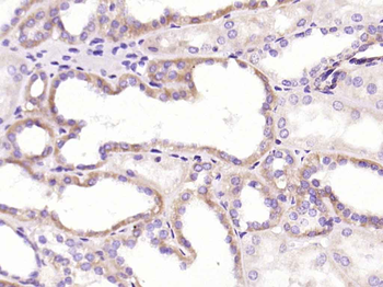 CRP (C11F2) Mouse Monoclonal Antibody