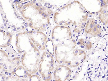 CRP (C11F2) Mouse Monoclonal Antibody